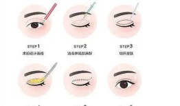 双眼皮手术的潜在副作用及其预防措施