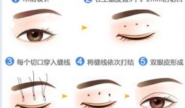 双眼皮手术后的潜在后遗症及其预防措施