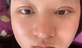 双眼皮手术与财运，迷信与现实的碰撞