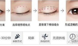 做双眼皮手术，后果、风险与恢复过程