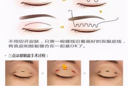 双眼皮手术的后遗症及其预防措施