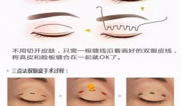 双眼皮手术的后遗症及其预防措施