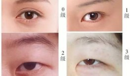 双眼皮手术后的后遗症，了解风险与预防措施