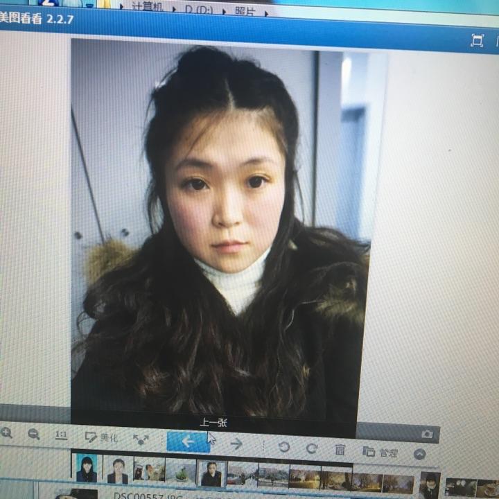 双眼皮手术，了解可能的后遗症及恢复过程
