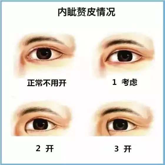 双眼皮手术后遗症,了解风险与预防措施 双眼皮手术后遗症,了解风险与预防措施
